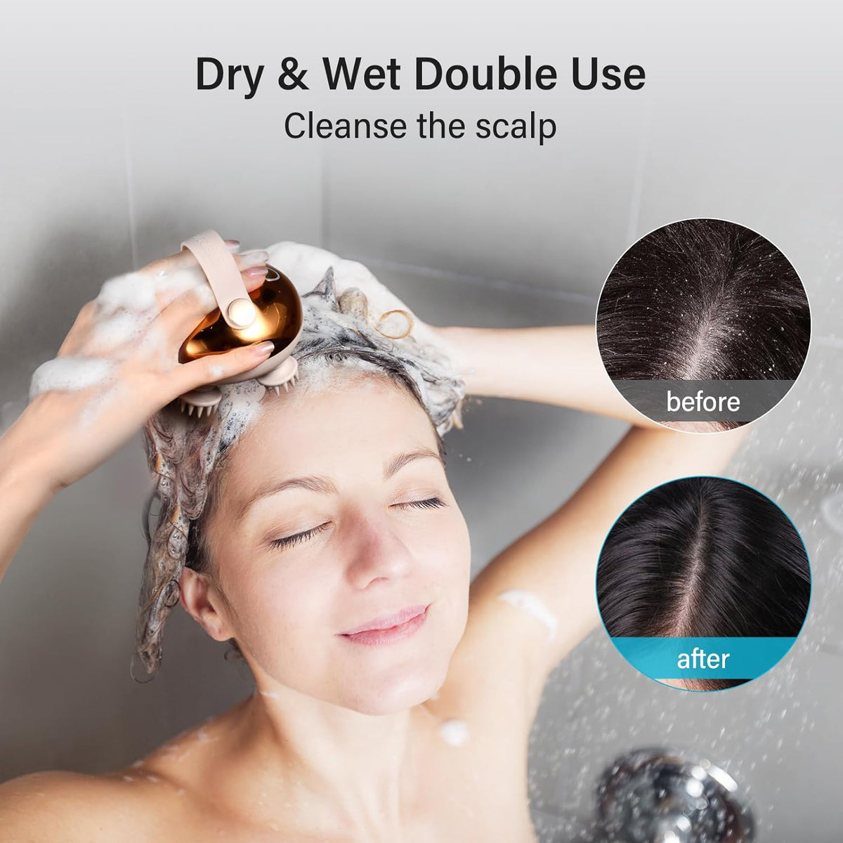 arboleaf Electric Scalp Massager, 360° Kneading Head Massager, 3 Modes, IPX7 Waterproof, Rechargeable Hair & Scalp Massage Device