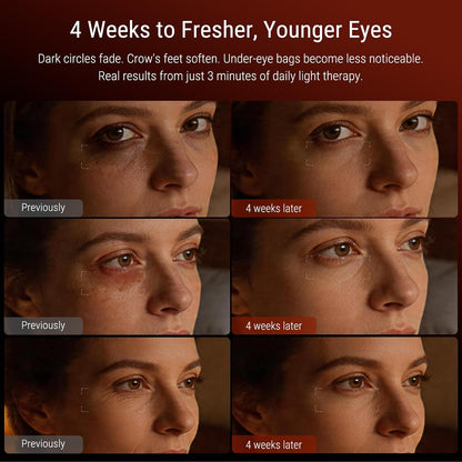 Red Light Therapy for Eyes, Targeted Under Eye Red Light Therapy Red Light Therapy Mask with 3-Minute Daily, 4 Wavelengths, Targets Wrinkles, Fine Lines, Dark Circles & Eye Bags (Black)