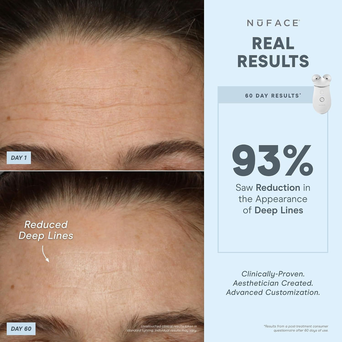 NUFACE Trinity+ Facial Massager - Face Firming & Toning Device for Lines & Wrinkles Treatment - FDA-Cleared Wrinkle Reducer + Lip & Eye Attachment + Aqua Gel Activator - 3 Frequency Microcurrent