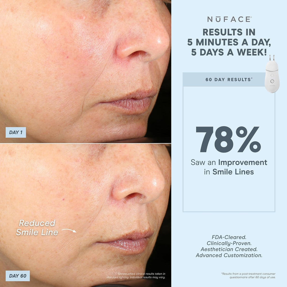 NUFACE Trinity+ Facial Massager - Face Firming & Toning Device for Lines & Wrinkles Treatment - FDA-Cleared Wrinkle Reducer + Lip & Eye Attachment + Aqua Gel Activator - 3 Frequency Microcurrent