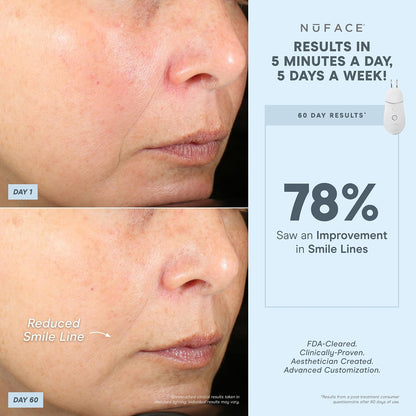 NUFACE Trinity+ Facial Massager - Face Firming & Toning Device for Lines & Wrinkles Treatment - FDA-Cleared Wrinkle Reducer + Lip & Eye Attachment + Aqua Gel Activator - 3 Frequency Microcurrent