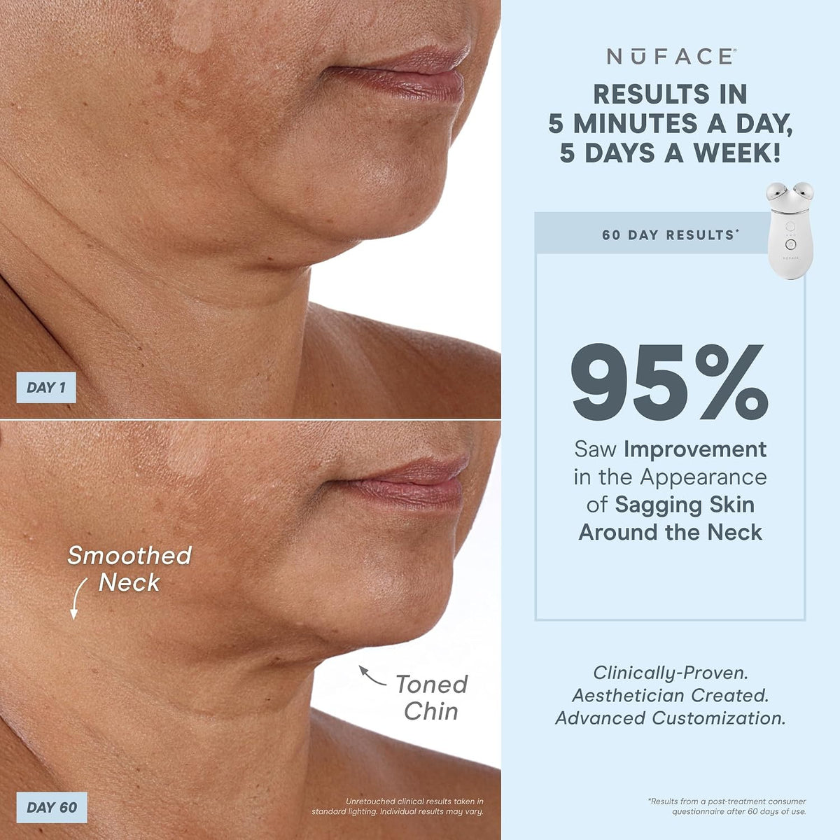 NUFACE Trinity+ Facial Massager - Face Firming & Toning Device for Lines & Wrinkles Treatment - FDA-Cleared Wrinkle Reducer + Lip & Eye Attachment + Aqua Gel Activator - 3 Frequency Microcurrent
