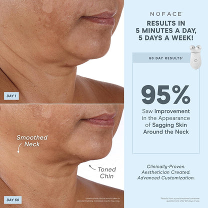 NUFACE Trinity+ Facial Massager - Face Firming & Toning Device for Lines & Wrinkles Treatment - FDA-Cleared Wrinkle Reducer + Lip & Eye Attachment + Aqua Gel Activator - 3 Frequency Microcurrent